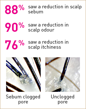 88% saw a reduction in scalp sebum and oiliness | 90% saw a reduction in scalp odour | 76% saw a reduction in scalp itchiness | Sebum clogged pore | Unclogged pore

